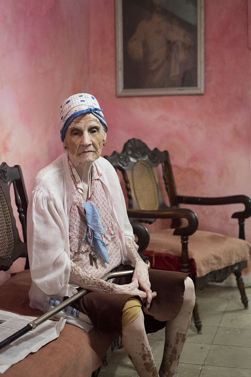 © Helga Salwe - Maria Hernandez suffers from a skin condition -Vitiligo. Which means she loses the pigmentation in her skin.