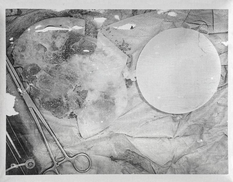 © Freisy González Portales - Image from the Sutura ¿Qué otro nombre tiene la herida? (Suture. What other name is there for a wound?) photography project