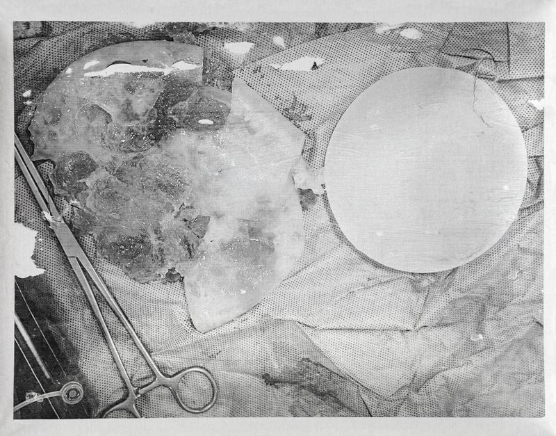 © Freisy González Portales - Image from the Sutura ¿Qué otro nombre tiene la herida? (Suture. What other name is there for a wound?) photography project