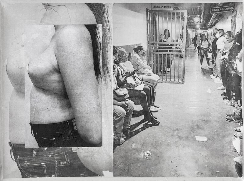 © Freisy González Portales - Image from the Sutura ¿Qué otro nombre tiene la herida? (Suture. What other name is there for a wound?) photography project