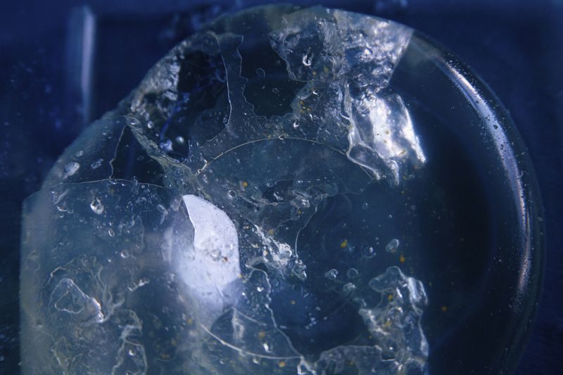 © Freisy González Portales - Broken implant (PIP) of Yurimara Amundaraín, replaced in 2007