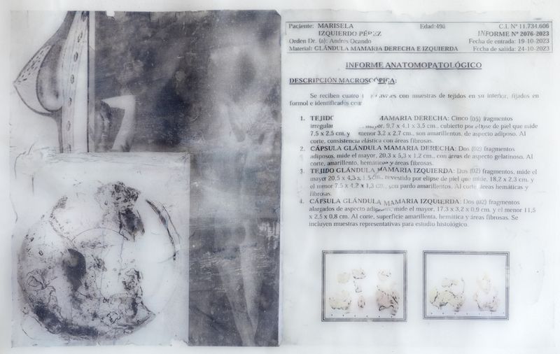 © Freisy González Portales - Image from the Sutura ¿Qué otro nombre tiene la herida? (Suture. What other name is there for a wound?) photography project