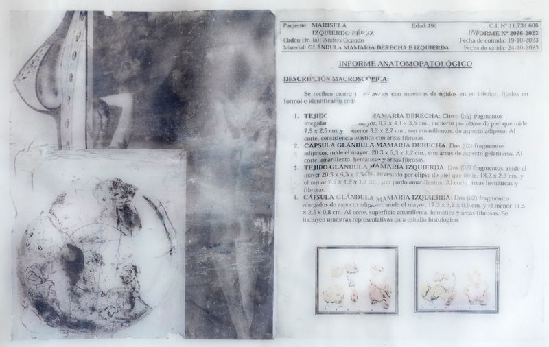 © Freisy González Portales - Image from the Sutura ¿Qué otro nombre tiene la herida? (Suture. What other name is there for a wound?) photography project