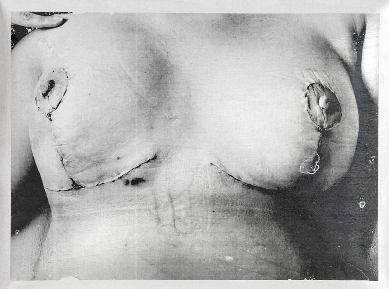 © Freisy González Portales - Image from the Sutura ¿Qué otro nombre tiene la herida? (Suture. What other name is there for a wound?) photography project