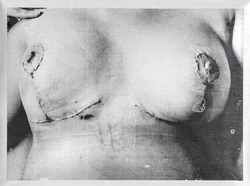 © Freisy González Portales - Image from the Sutura ¿Qué otro nombre tiene la herida? (Suture. What other name is there for a wound?) photography project