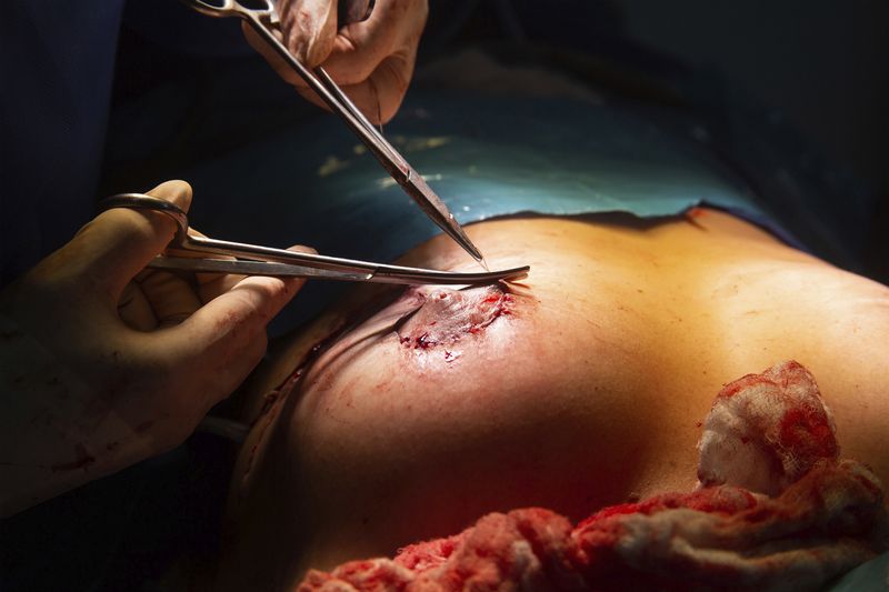© Freisy González Portales - María Machado's explant surgery, performed by surgeon Andrés Ocando in July 2025.