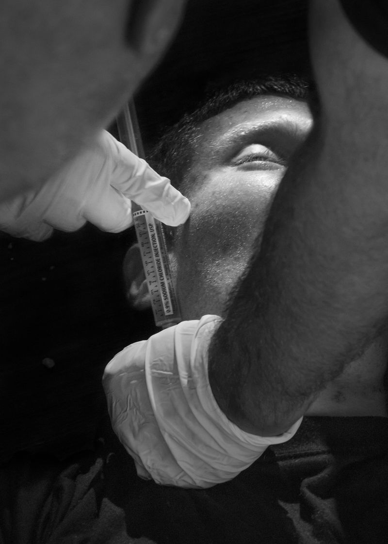 © Philip Montgomery - Image from the Faces of an Epidemic  photography project