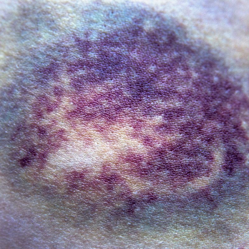 © Enikő Hodosy - Image from the Invisible-you photography project