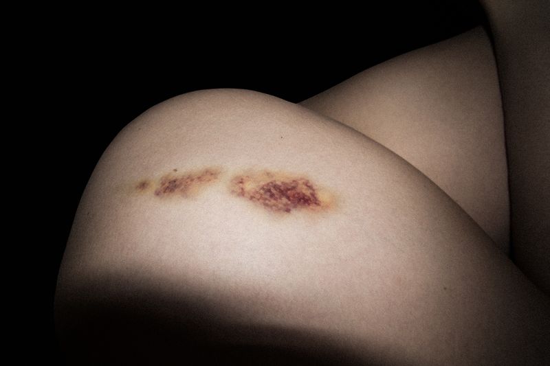 © Enikő Hodosy - Image from the Invisible-you photography project