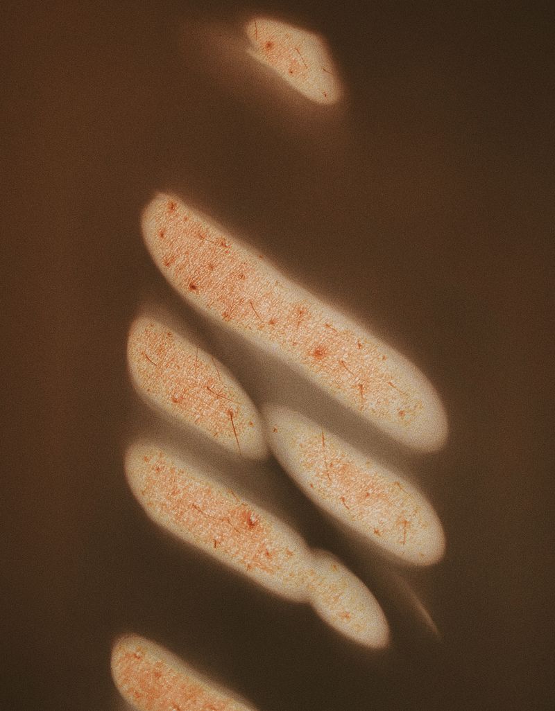 © Ashima Raizada - Skin finding its way through