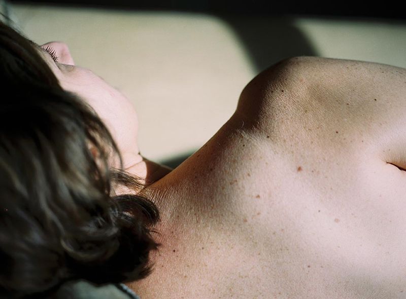 © Lidewij Mulder - My mothers birthmarks (2018)
