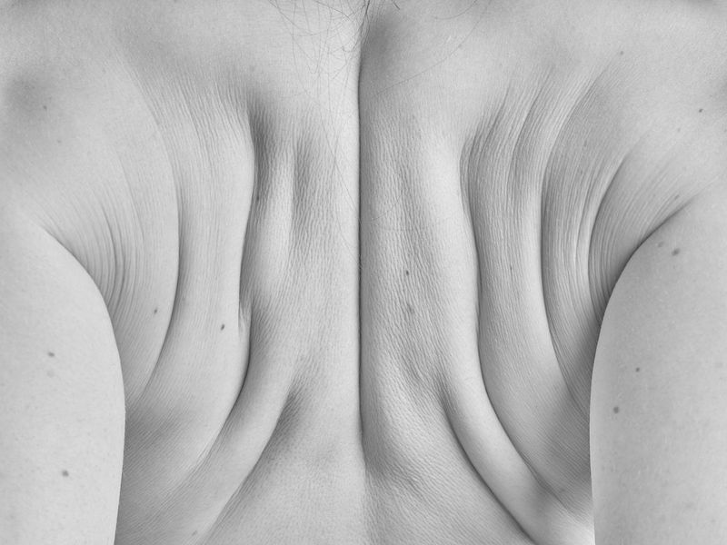 © Jakub Kolek - Image from the Open fracture of life photography project