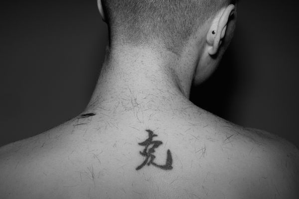 © Jakub Kolek - Image from the Open fracture of life photography project