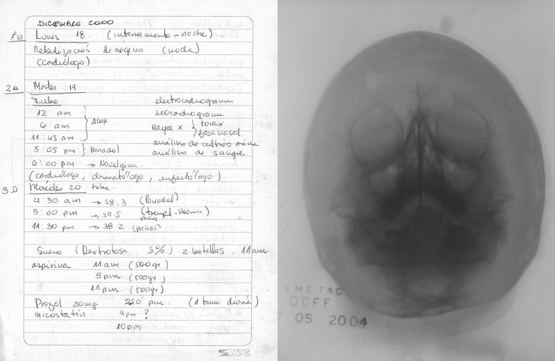 © Fiorella Del Castillo - Image from the Residuos de un contacto: Manipulación photography project