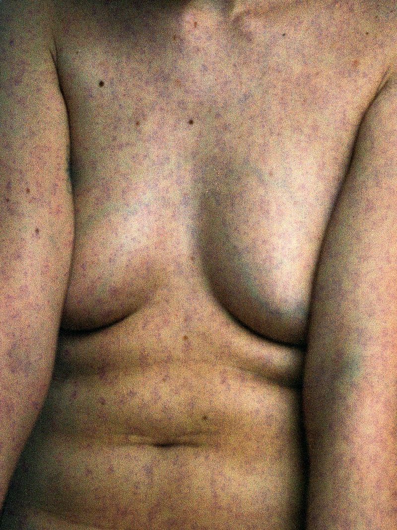 © Fiorella Del Castillo - Image from the Residuos de un contacto: Manipulación photography project