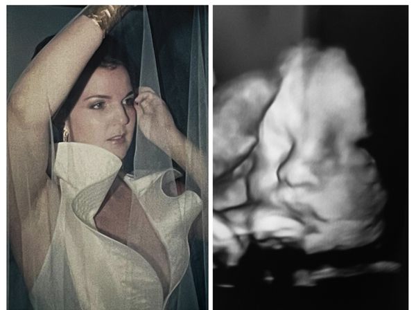 © Marilia Vieira - 'The Veil/Colossus', (2003/2017) Archival photograph and ultrasound of my youngest son