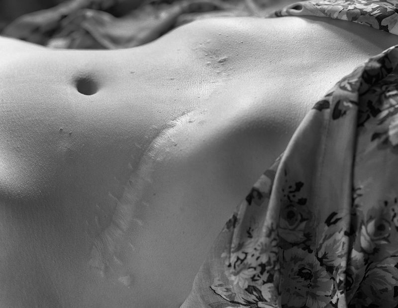 © Izabela Jurcewicz - Left