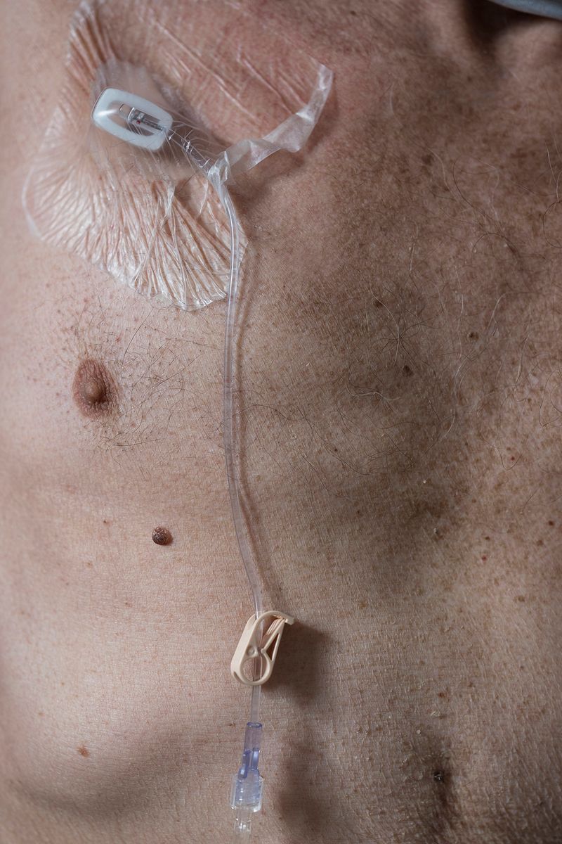 © Izabela Jurcewicz - Chemo