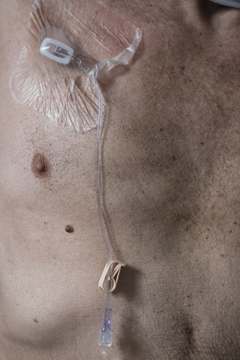 © Izabela Jurcewicz - Chemo