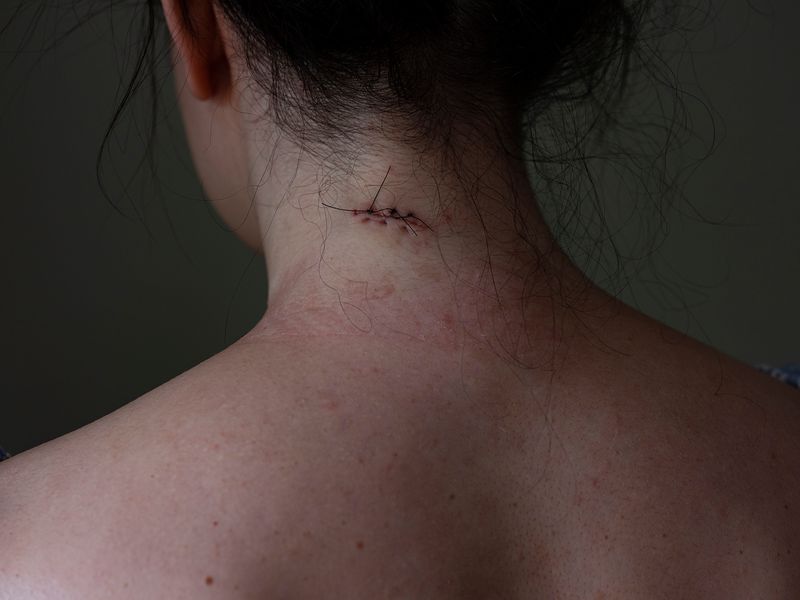 © Izabela Jurcewicz - Neck Pain