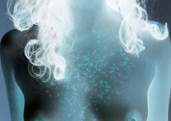 © Izabela Jurcewicz - Rash