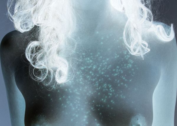 © Izabela Jurcewicz - Rash