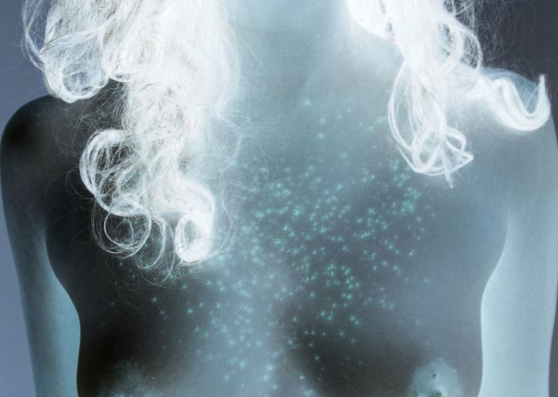 © Izabela Jurcewicz - Rash