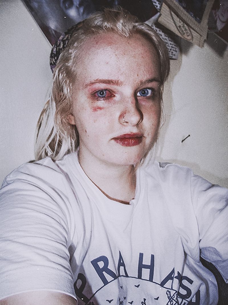 © Lily Zoumpouli - "Infected" 2017