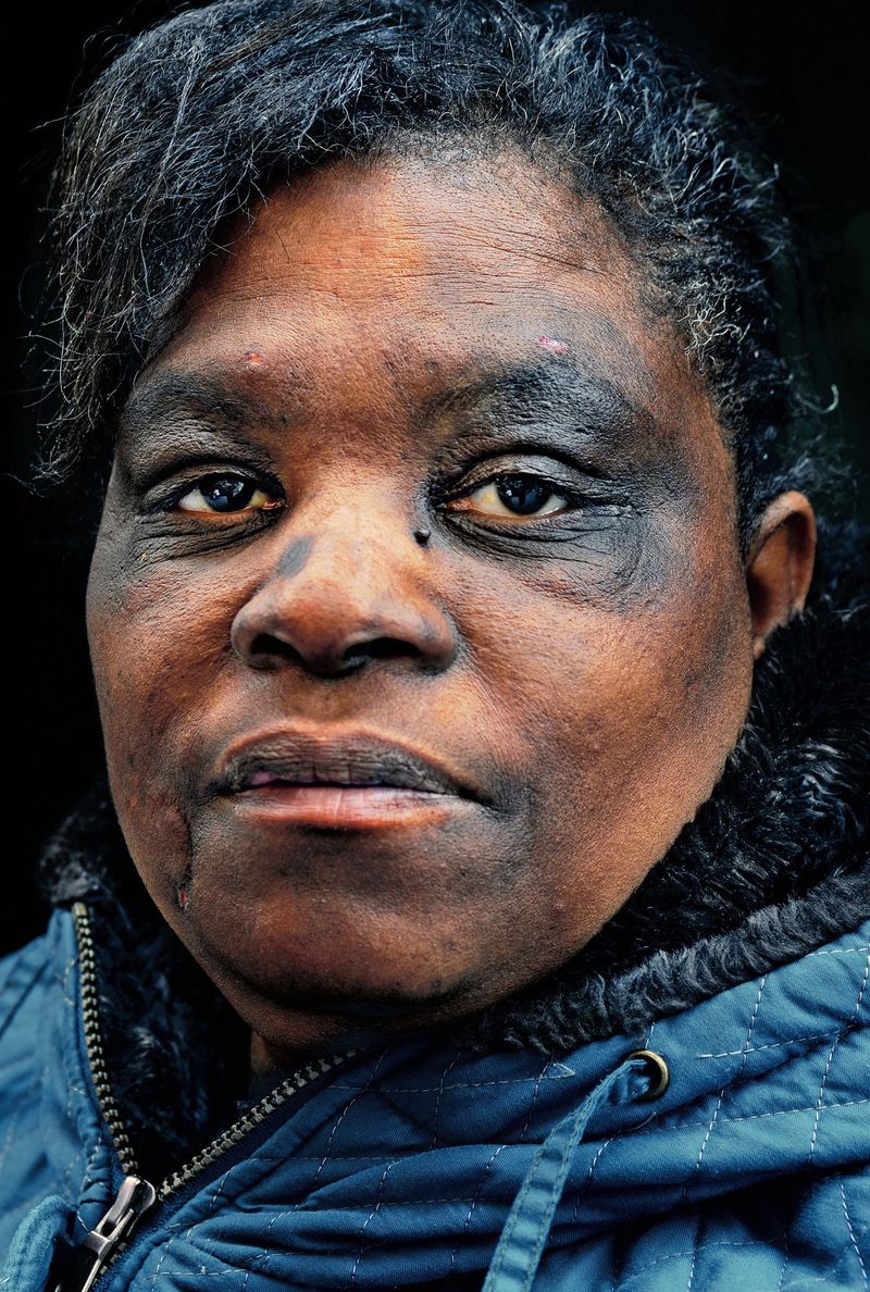 © Graeme Williams - Harrisburg, USA. 2016. Stephanie Cuthbertson, gets her meals at a local food kitchen. She wouldn't say who had beaten her.