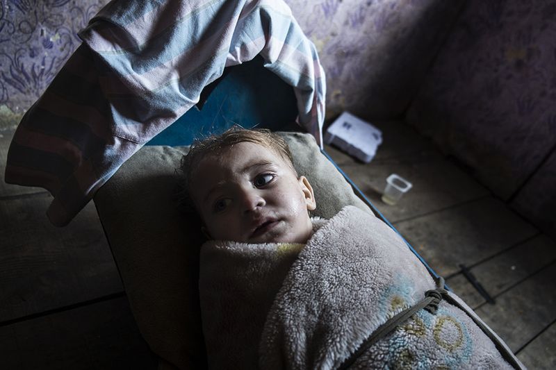 © Gianmarco Maraviglia - Camp Konic, Podgorica, Montenegro. A little sick child is sleeping in a shack with no water, in Konic 1