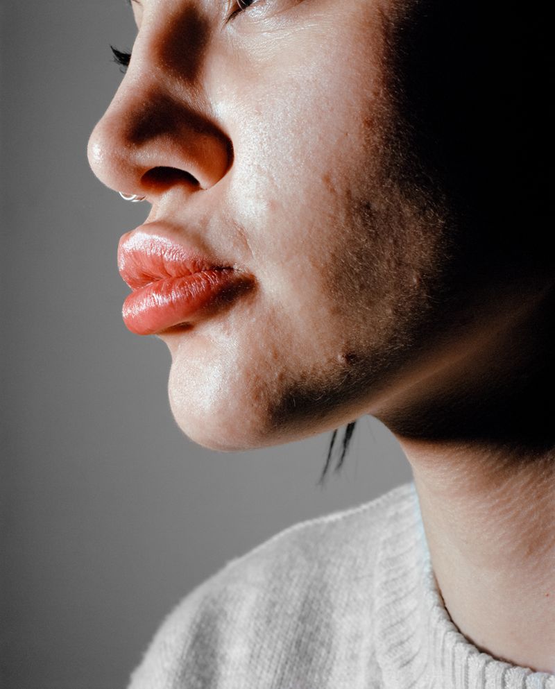 © Sjoerd Houben - R after treatment three, 2017