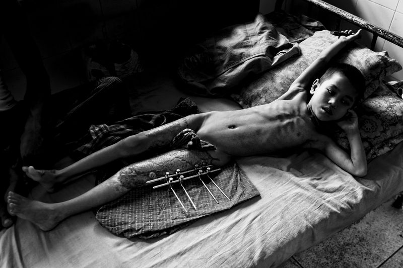 © Mohammad Rakibul Hasan - Image from the I am Rohingya photography project