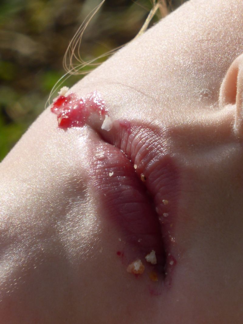 © Chiara Benzi - Image from the Endure photography project