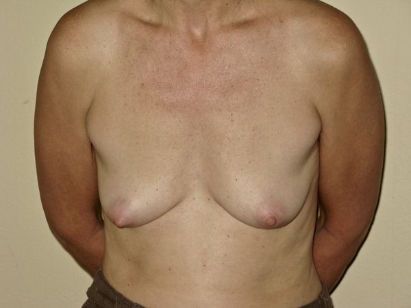 © Chloe Kemp - Image from the Loving Our Bodies And Ourselves photography project