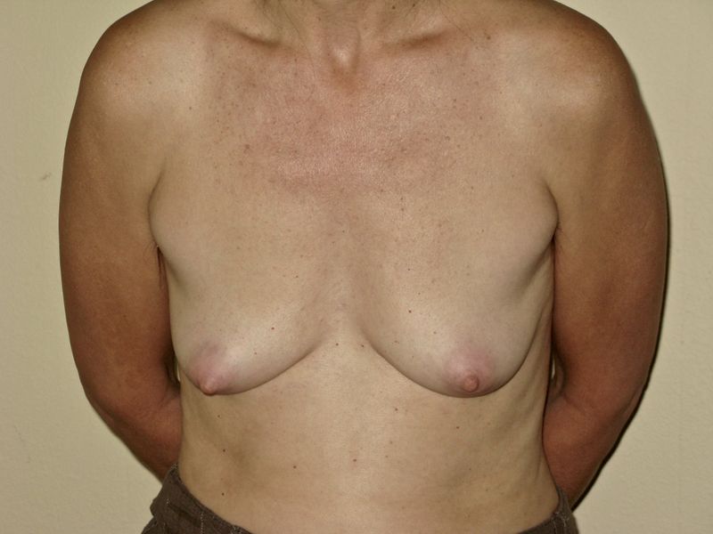 © Chloe Kemp - Image from the Loving Our Bodies And Ourselves photography project