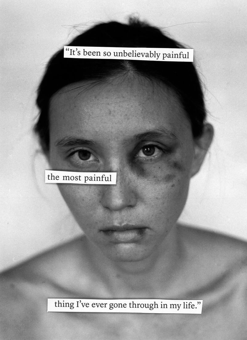 © Kimbra Audrey - the most painful