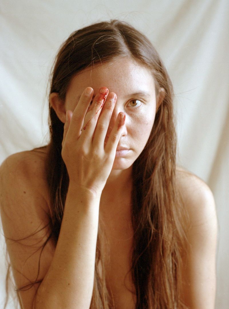 © Kimbra Audrey - accident, self-portrait