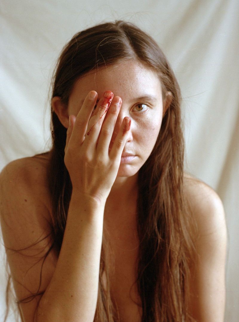 © Kimbra Audrey - accident, self-portrait