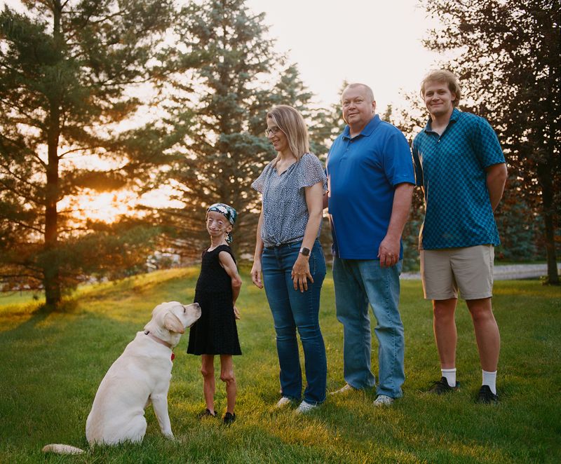 © Logan  White - Kaylee stands with her service dog, Iris; her mother, Marla; her father, Tim; and one of her three brothers, Jacob.