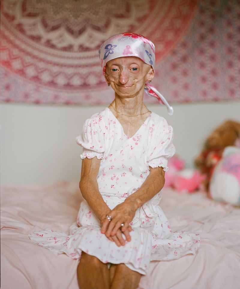 © Logan  White - Kaylee in her bedroom.