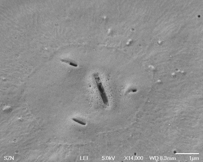 © Gaia Maggio - Bacteriastrum hyalinum, SEM Microscope, Zoological Station Anton Dohrn Naples.