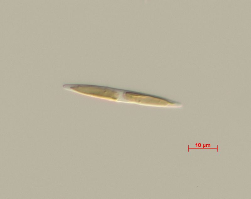 © Gaia Maggio - Pseudo-nitzschia multistriata, LM Microscope, Zoological Station Anton Dohrn Naples.