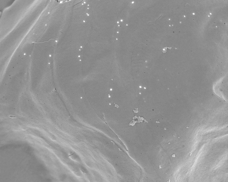 © Gaia Maggio - Chaetoceros dichaeta, SEM Microscope, Zoological station Anton Dohrn Naples.