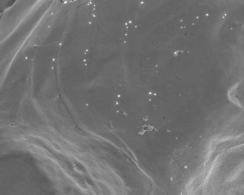 © Gaia Maggio - Chaetoceros dichaeta, SEM Microscope, Zoological station Anton Dohrn Naples.