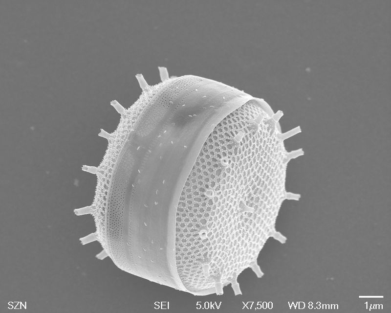 © Gaia Maggio - Cyclotella sp, SEM Microscope, Zoological Station Anton Dohrn Naples.
