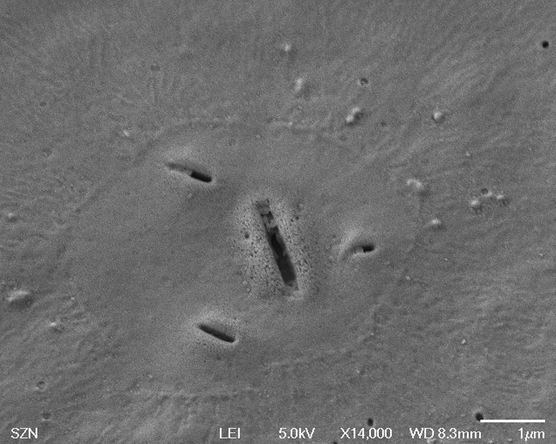 © Gaia Maggio - Bacteriastrum hyalinum, SEM Microscope, Zoological Station Anton Dohrn Naples.