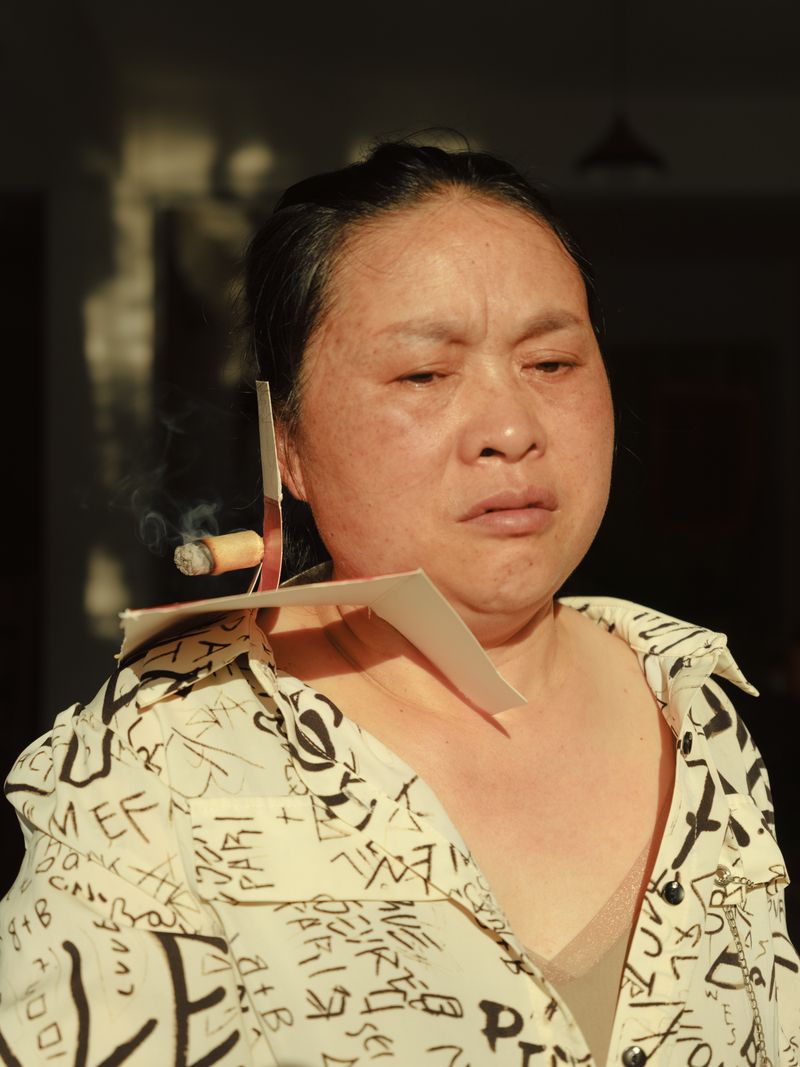 © Yixi Tian - A villager with shoulder pain comes for treatment.