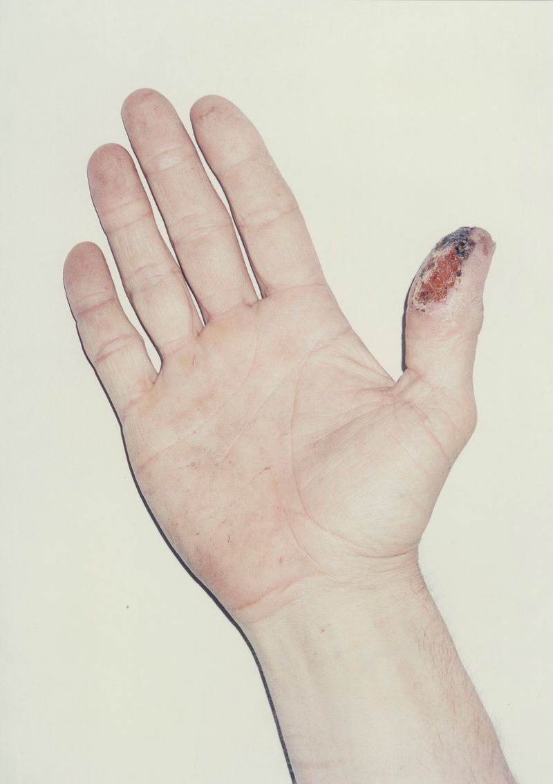 © Laving - Image from the Fever photography project