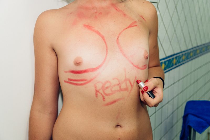 © Francesca De Chirico - VIII. July 2016, the night before the surgery.