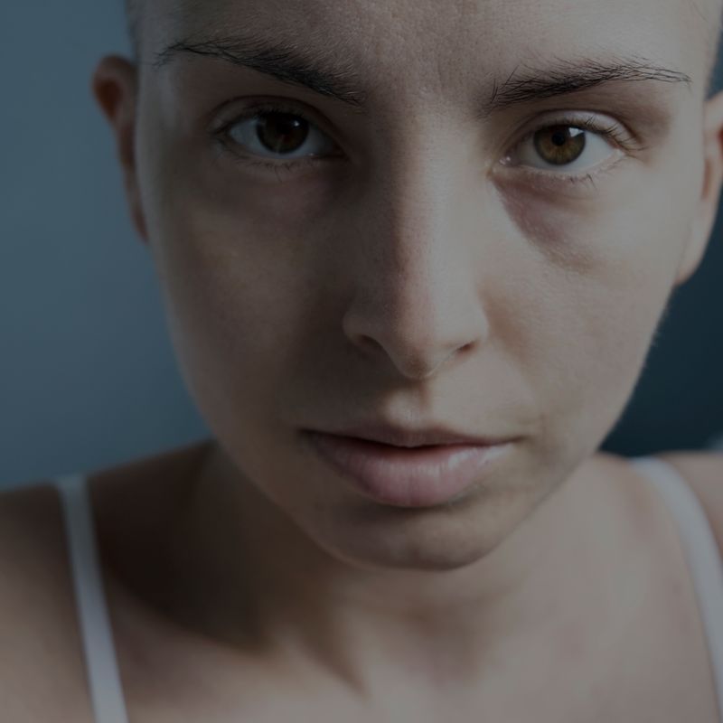 © Marta Viola - Image from the Sangue bianco photography project